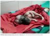 3headedbaby.JPG 3headedbaby.JPG