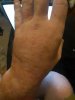 my poor hand.jpg my poor hand.jpg